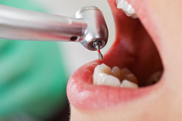 Best Emergency Dentist for Special Needs Patients in Bunk Foss, WA